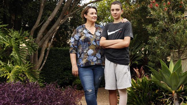 Helen Higgie and her son Aiden, 14, who received third degree burns to his leg. Picture: Tim Hunter