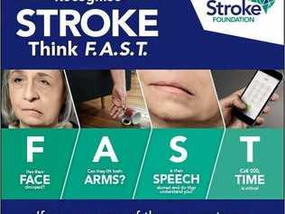 ACT FAST: How to recognise a stroke. Picture: Contributed