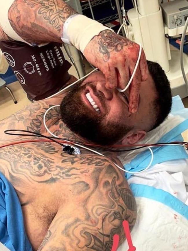 John Lavulo in hospital after being shot in Warwick Farm last year. Picture: Instagram