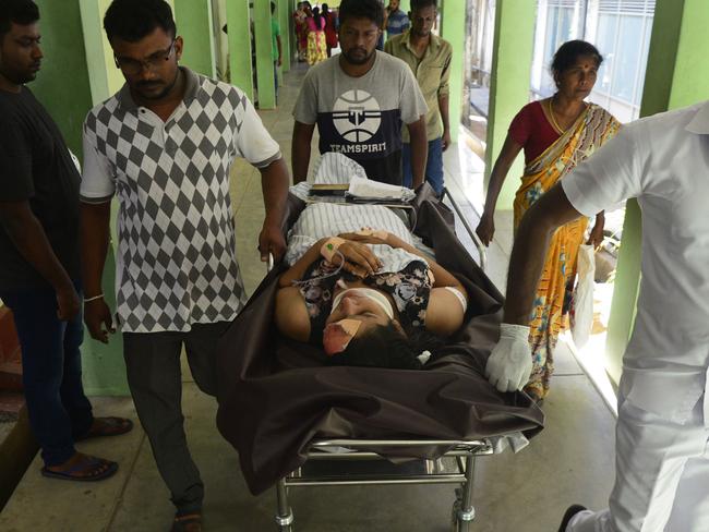 An injured Sri Lankan woman is transported on a stretcher at a hospital following an explosion at a church in Batticaloa. Picture: AFP 