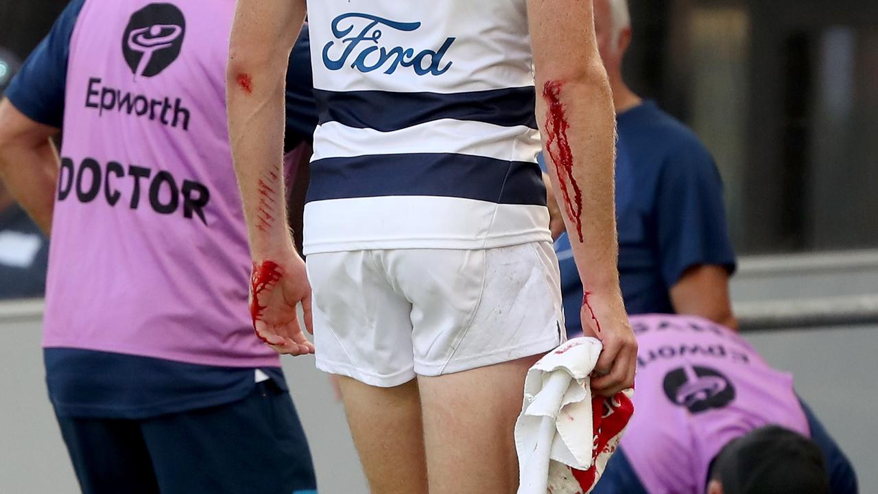 Geelong’s Mark Blicavs comes off with blood after running into the Optus Stadium fence during the loss to West Coast. (Photo by James Elsby/Getty Images)