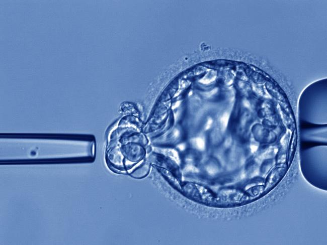 Scientists at Monash IVF Group  have developed a non-invasive embryo screening test that will reduce miscarriages and the time it takes to achieve a healthy live birth.