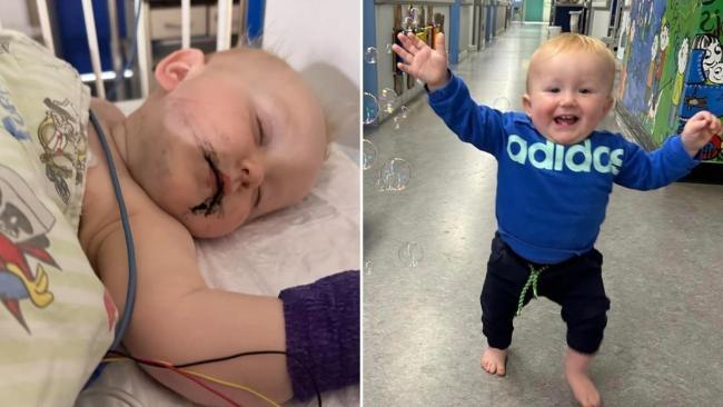 Alfred spent 72 hours in hospital before being released 
