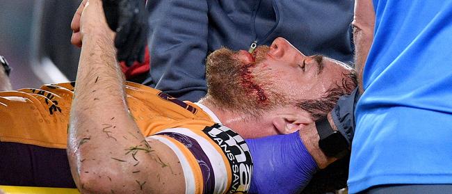 McCullough was concussed following the heavy tackle. AAP Image/Dan Himbrechts.