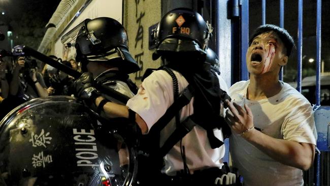 A bleeding man is taken away by policemenin the latest violence. Picture; AP.