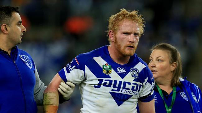 James Graham is led from the field during his playing days at the Bulldogs. Picture: Mark Evans