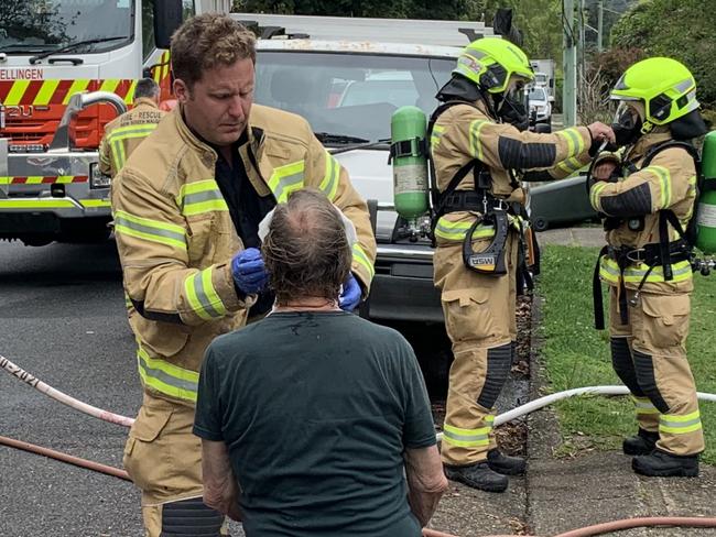 A man being treated for burns to the face on Lyon Street, Bellingen, on Thursday, October 6.