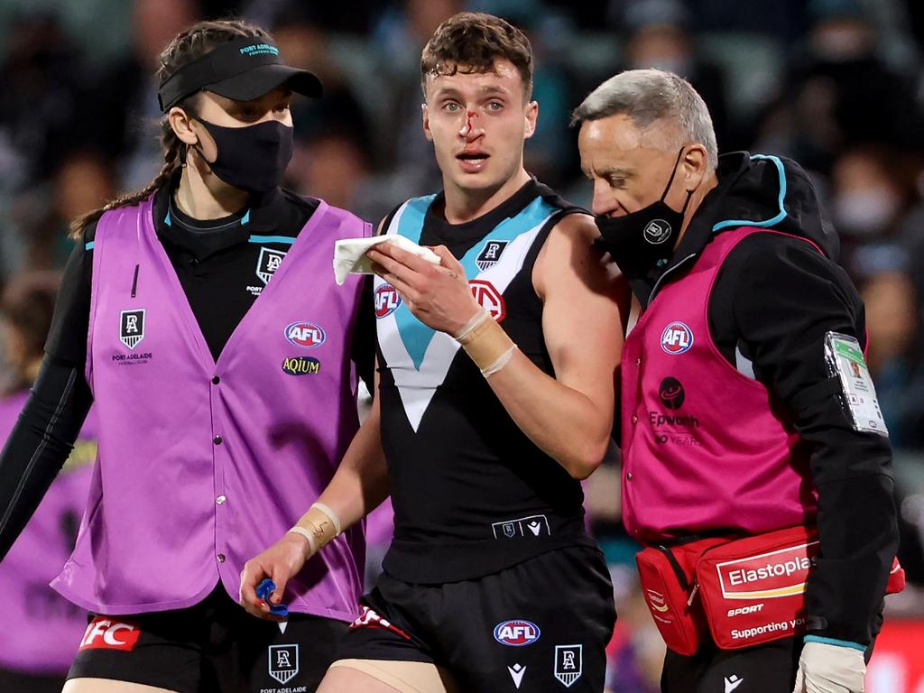 Orazio Fantasia is helped from the ground against Geelong. Picture: Getty Images