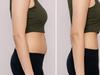 Truth about weight loss ‘miracle’ drug