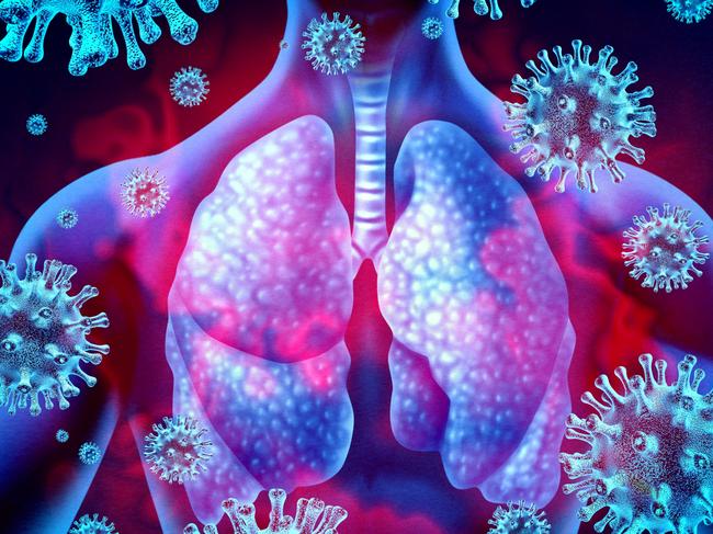 Lung virus infection and coronavirus outbreak or viral pneumonia and coronaviruses influenza as a dangerous flu strain cases as a pandemic medical health risk concept with disease cells with 3D render elements.