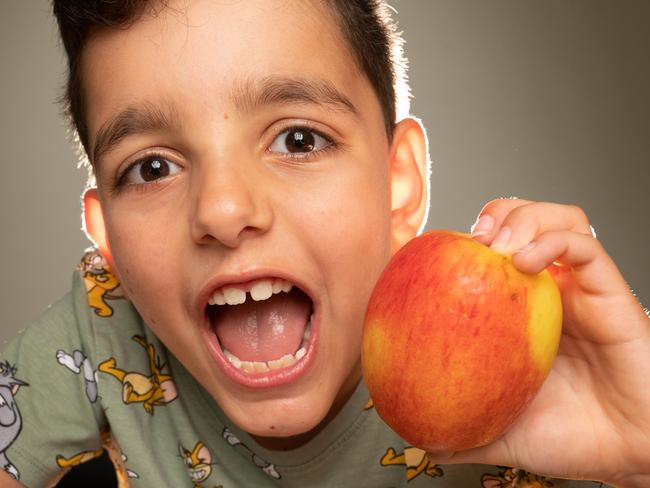 Antonio Stamatis (8yr) had Chalky Teeth. IT'S baffled dentists and scientists for a century, but finally Melbourne researchers have discovered the root cause of children's chalky teeth. Picture: Tony Gough