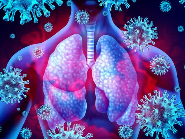 Lung virus infection and coronavirus outbreak or viral pneumonia and coronaviruses influenza as a dangerous flu strain cases as a pandemic medical health risk concept with disease cells with 3D render elements.