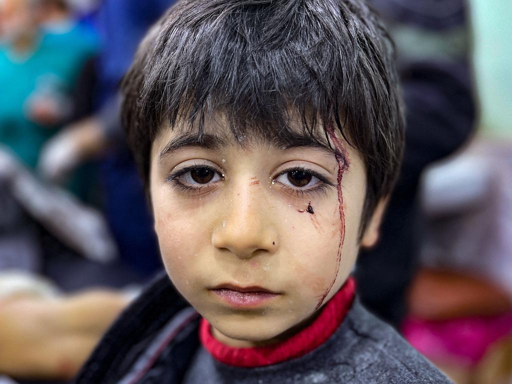 An injured child awaits treatment at the Bab al-Hawa hospital following an earthquake in the rebel-held northern countryside of Syria's Idlib province on the border with Turkey. Picture: Aaref Watad / AFP.