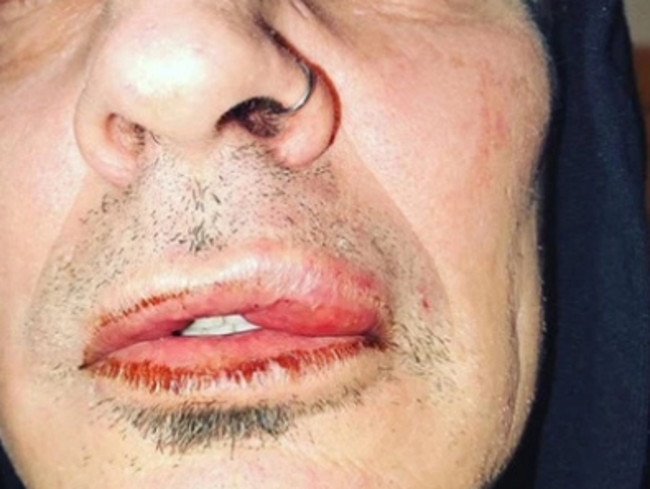 Former Motley Crue drummer Tommy Lee 'beaten up by son' with ex Pamela  Anderson, Brandon Lee  — Australia's leading news site