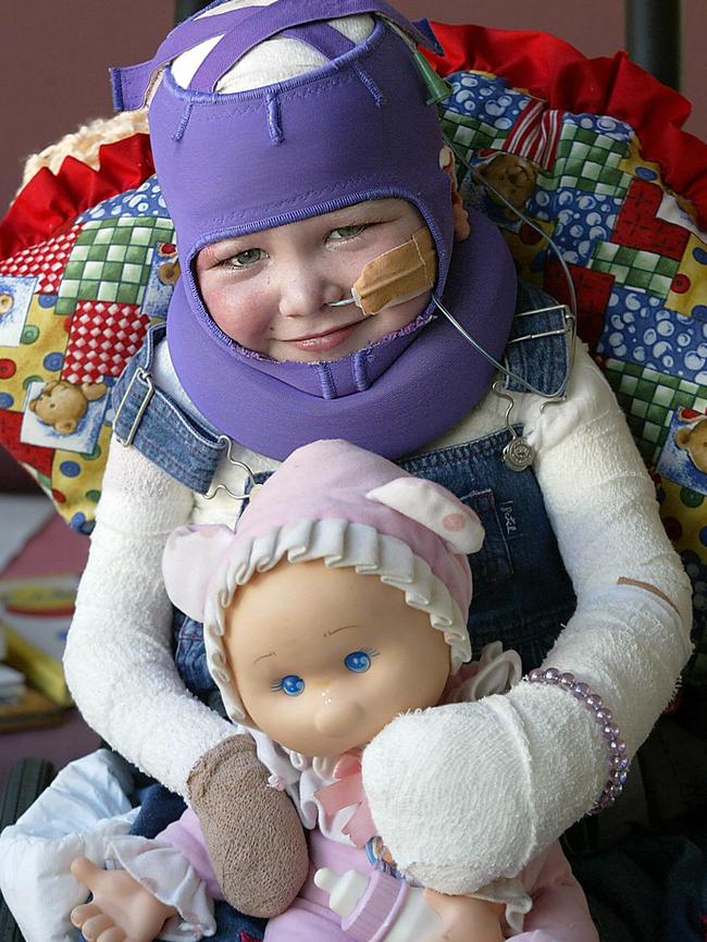 Three-year-old Sophie Delezio recovering in Westmead Childrens Hospital. Picture: Marc McCormack