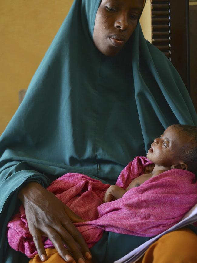 A severely malnourished child lies in the hands of her mother in Somalia. Picture: AFP.