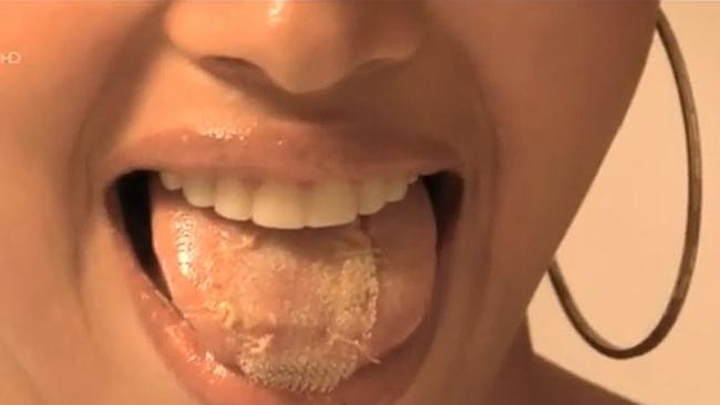 Miss Venezuela 2013 beauty queen contestant shows the mesh sewn to her tongue to stop her from eating.
