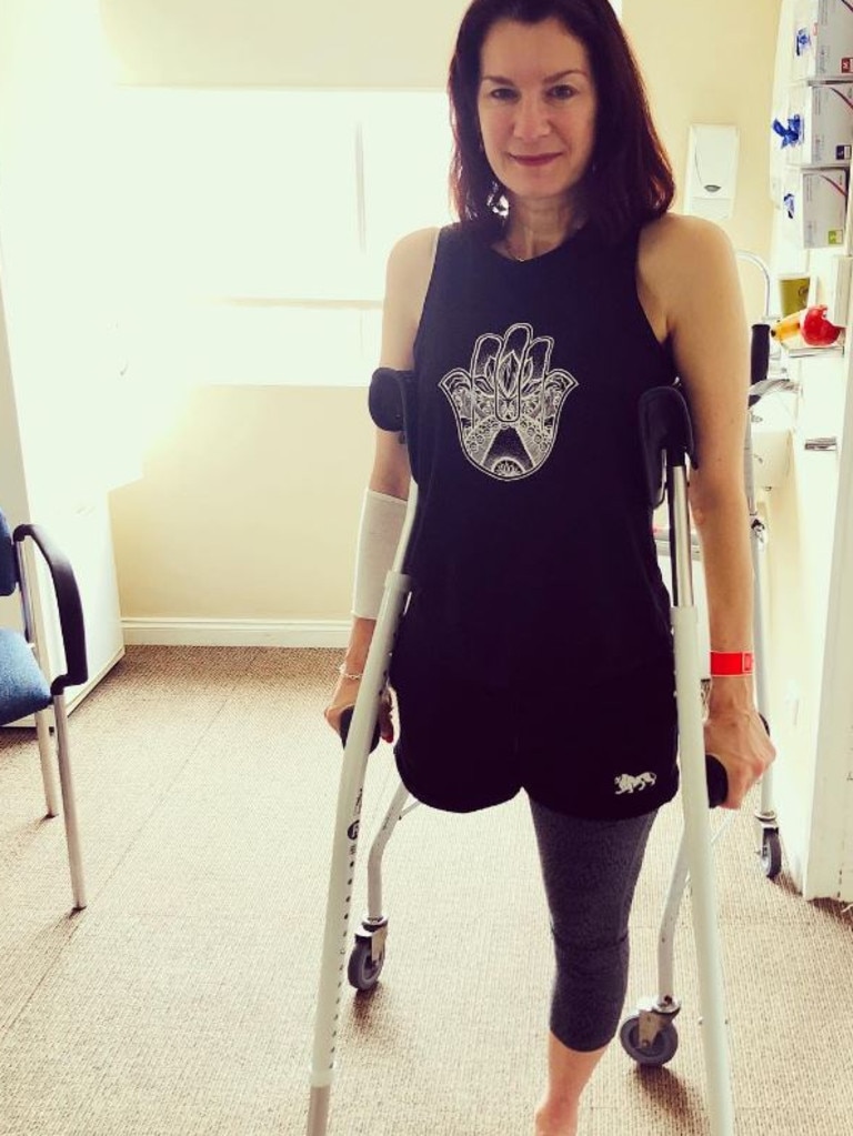 Anne had her entire leg removed. Picture: Instagram: @anne__bionica