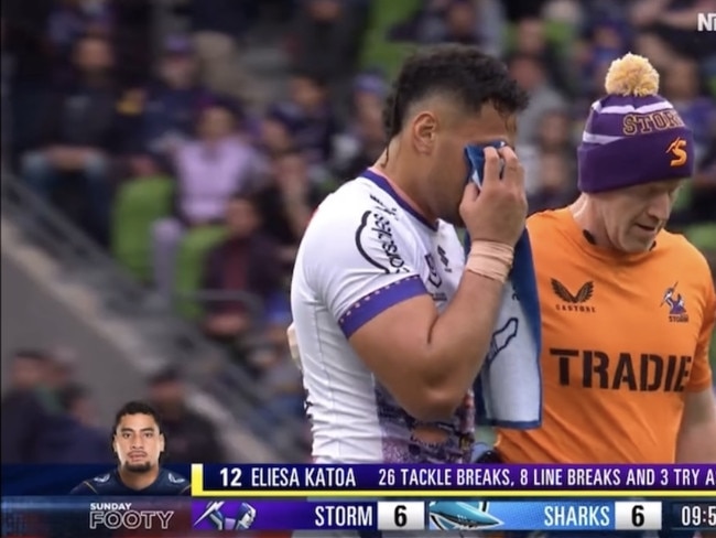 Eli Katoa was left fearing he would be blind for life after tearing his retina.
