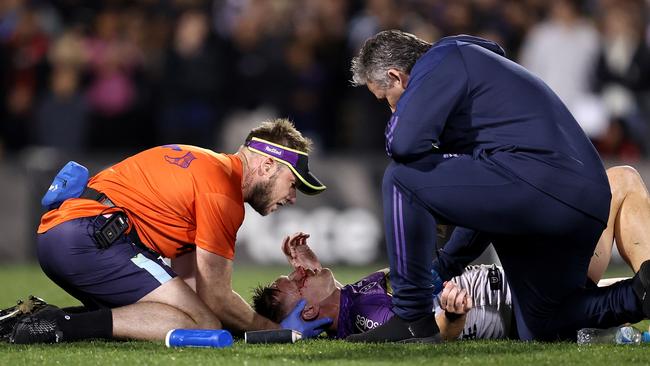 Cameron Munster receives attention after a nasty head clash. Picture: Brendon Thorne/Getty Images