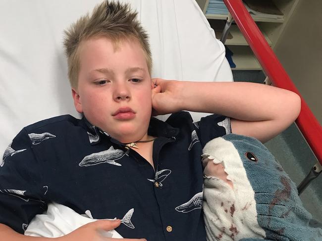 Huckleberry Myers, 9, recovering in the Women's and Children's Hospital after he was stabbed during a violent car robbery outside his family's Unley home. Picture: supplied by family