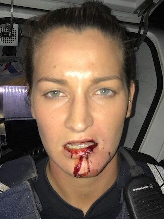 Senior Constable Maxine Phillips was attacked so fiercely by ice-addicted burglar her teeth ended up puncturing her lip.