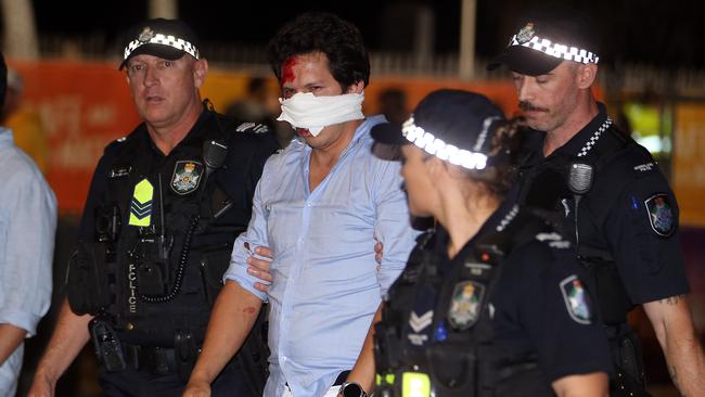 An injured man at Schoolies. Picture: AAP