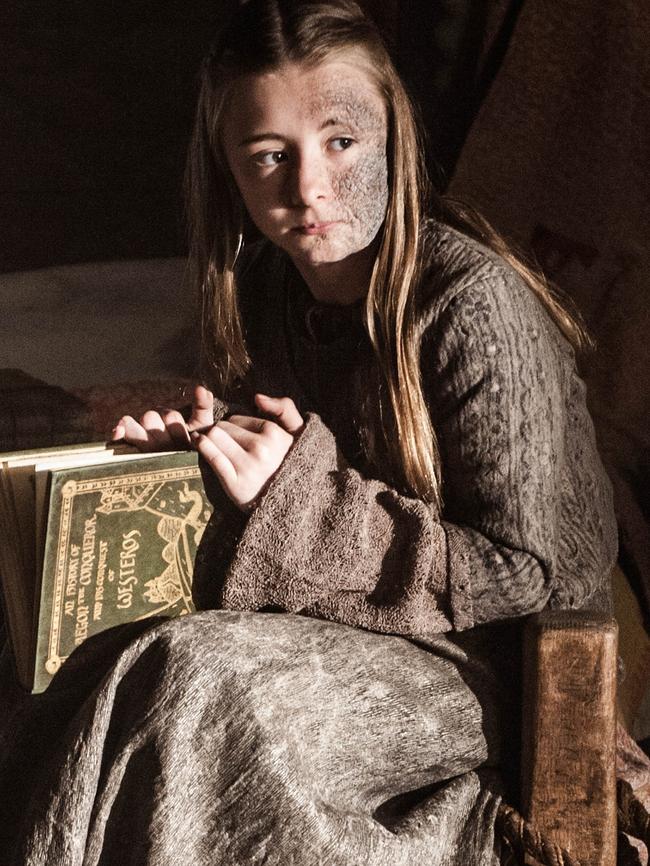 Kerry Ingram as the unfortunate Shireen Baratheon.