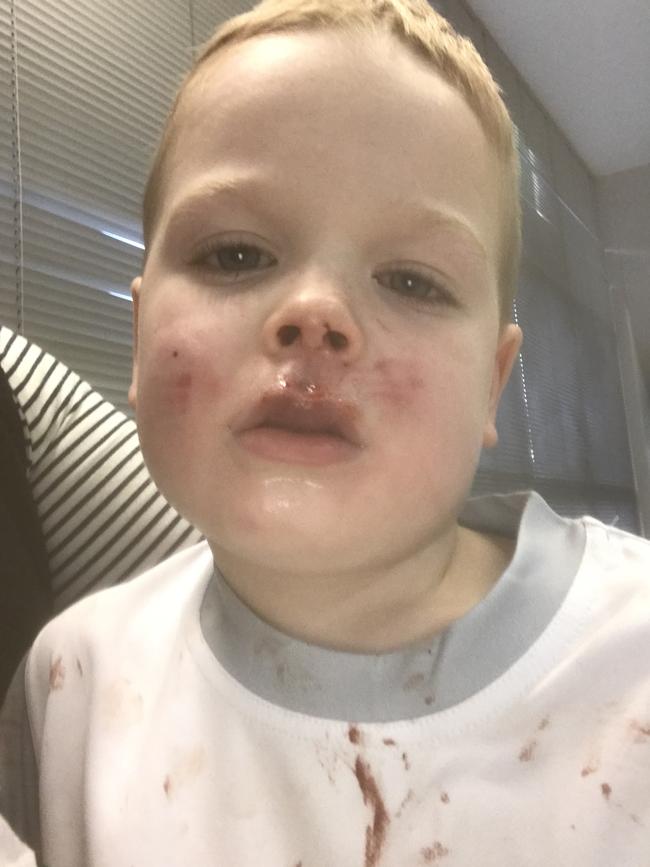 Joey suffered facial injuries and was bleeding heavily. Picture: Supplied