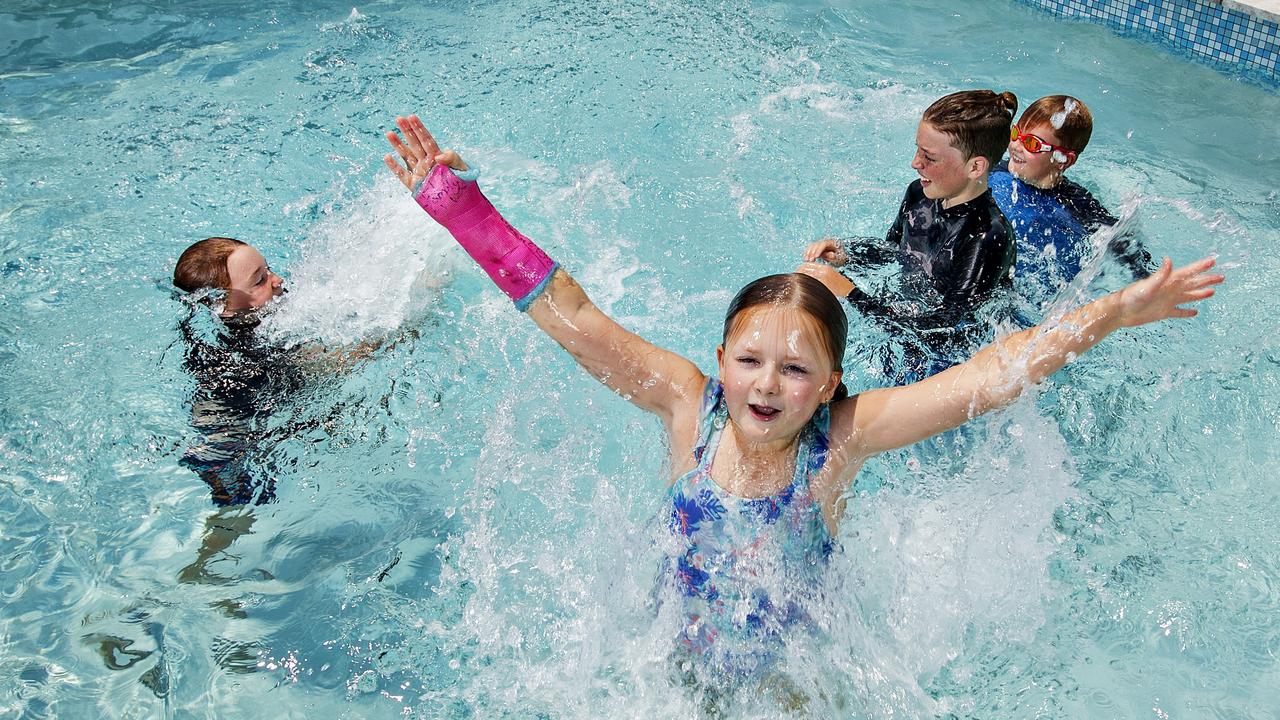 Waterproof casts in high demand for Gold Coast surfers and swimmers at ...