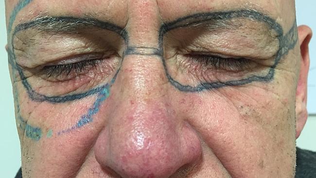 UK man's shocking Ray-Ban sunglasses tattoo after drunk bucks party |   — Australia's leading news site