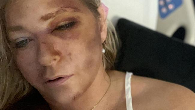 Virginia Giuffre had claimed she was dying. Picture: Instagram