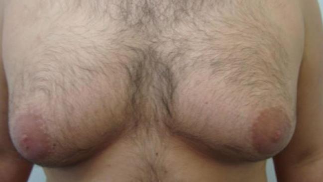 Before surgery.