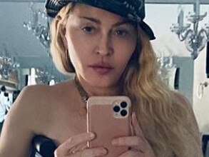 Madonna poses topless while leaning on crutch. Picture: Instagram