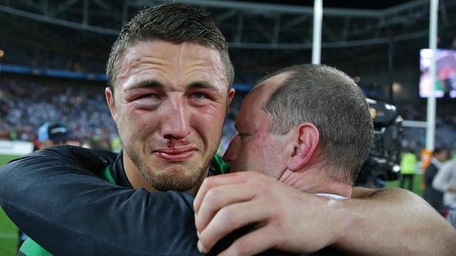 Sam Burgess and that fractured eye socket suffered in the first hit-up of the 2014 grand final when South Sydney beat Canterbury at ANZ Stadium. Picture Gregg Porteous