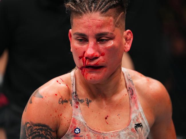 Priscila Cachoeira was left a bloodied, beaten mess. Picture: Jeff Bottari/Zuffa LLC via Getty Images