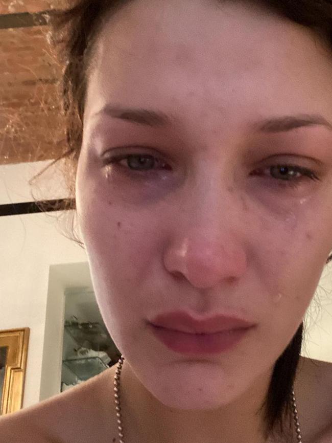 Bella Hadid previously detailed her ‘excruciating’ struggle with mental health. Picture: Instagram/bellahadid