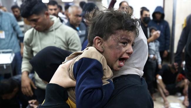 An injured Palestinian boy at Al-Aqsa hospital in Deir Balah, central Gaza. Picture: AFP