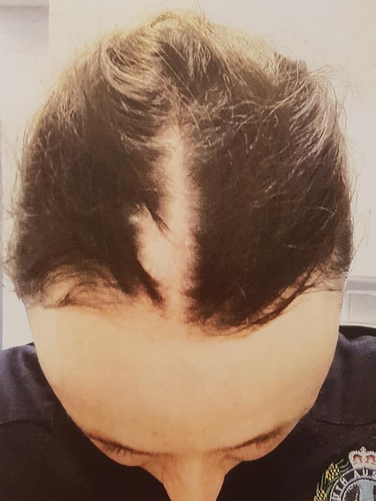 Cruise tore hair and skin from Constable Beck’s scalp. Picture: District Court registry