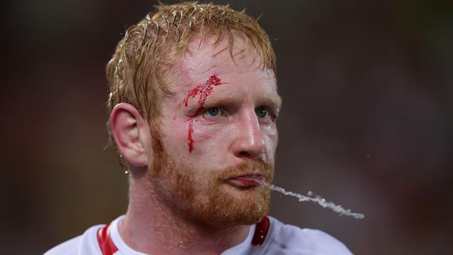 James Graham won’t apologise for his on-field spray during the World Cup final.