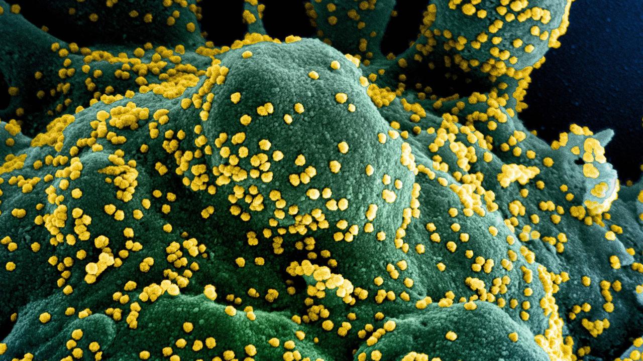 XEC has some new mutations that might help it spread quickly through Australia this summer, leading to increased cases. Picture: National Institute of Allergy and Infectious Diseases / AFP