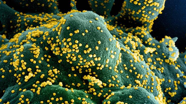 XEC has some new mutations that might help it spread quickly through Australia this summer, leading to increased cases. Picture: National Institute of Allergy and Infectious Diseases / AFP