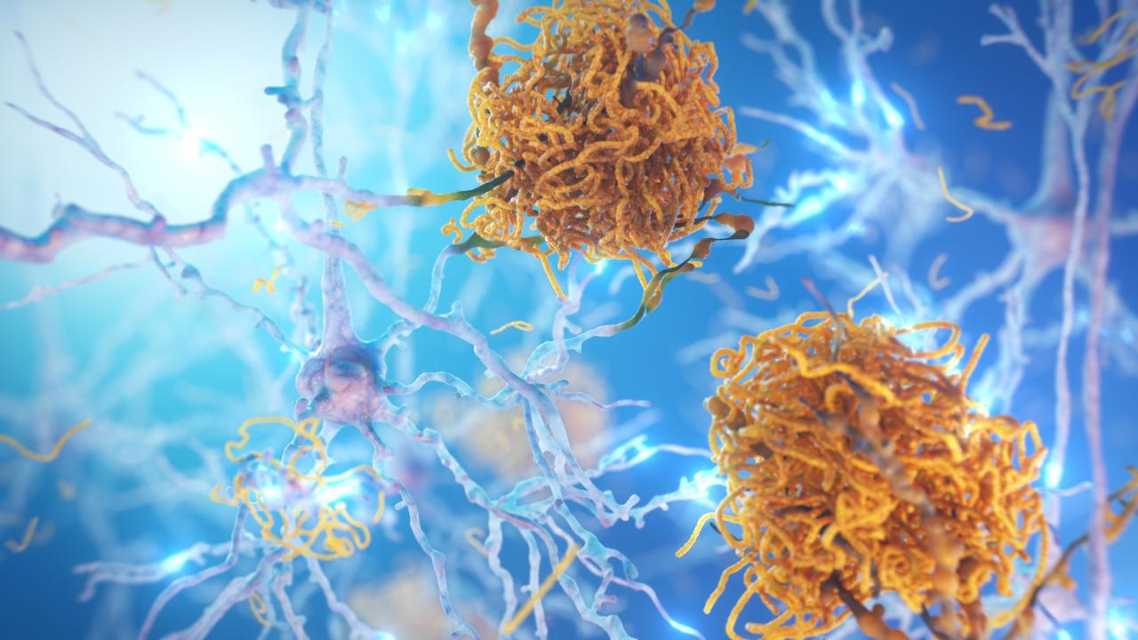 ‘Window of opportunity’ widens for Alzheimer’s sufferers