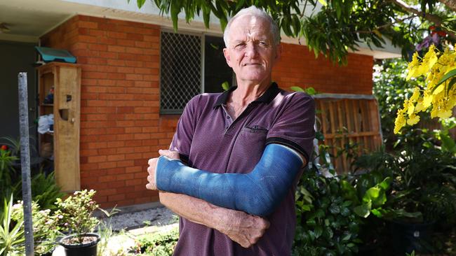 Cliff Sparks had a machete swung at his head and his arm broken by a crowbar in an attack two months ago. He believes that the government's latest crime figures are skewed, as most youth criminals avoid a conviction. Picture: Brendan Radke