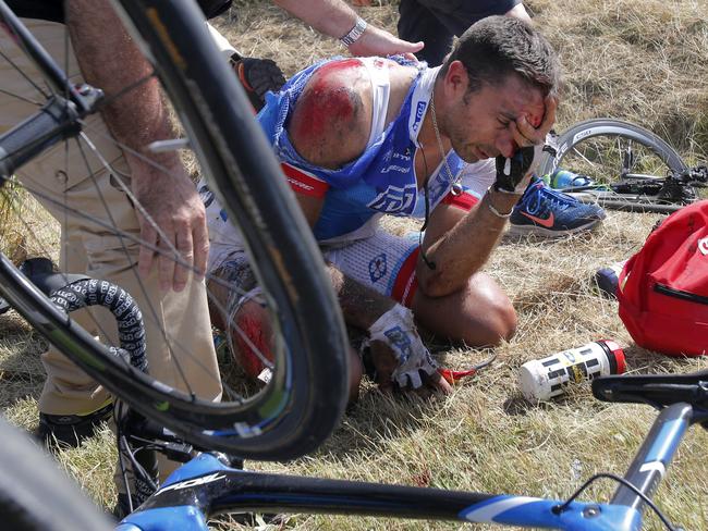 William Bonnet of France holds his head after the crash.