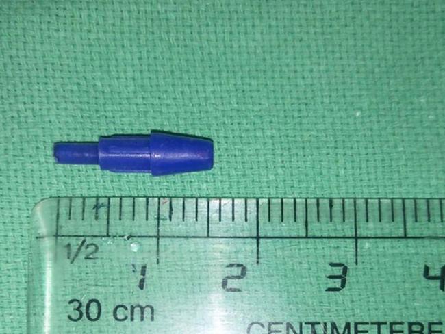 Doctors Find Pen Tip In Boys Penis In Rare Medical Case News Com Au Australias Leading