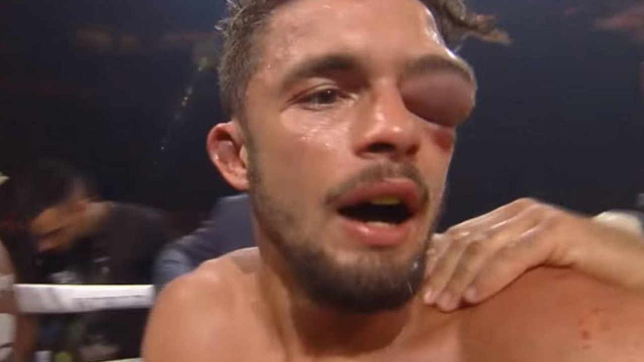 Anthony Yigit's face was absolutely devastated during his fight with Ivan Baranchyk