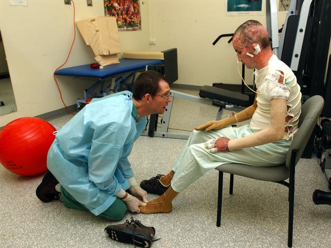 Antony Svilicich and Senior Burns Physio Dale Edgar at RPH Picture: Tom Rovis-Hermann