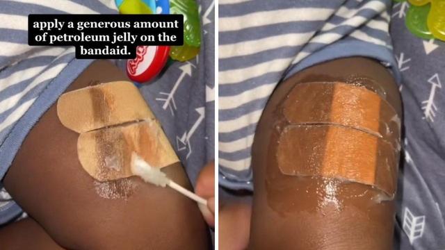 TikTok mum's incredible hack makes BAND-AIDS slide off with no pain