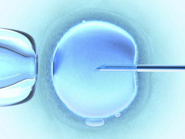 Generic image of an IVF needle in female egg.